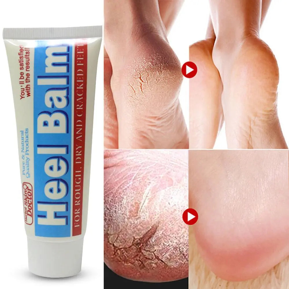 Masterplast Heel Balm pour talon sec craquelé et gercé 70 g masterplast